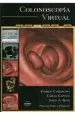 PDF Colonoscopia Virtual del autor Carlos Capuñay