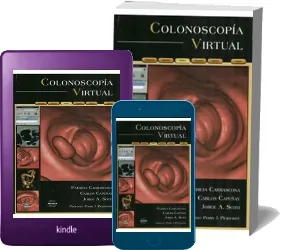 Colonoscopia Virtual descarga gratis online