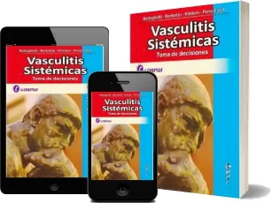 Leer PDF Vasculitis Sistemicas. Toma de Decisiones descarga gratis + resumen