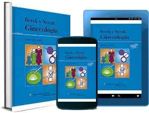 eBook online + resumen Ginecologia
