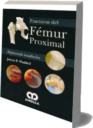 Descarga ePub de Mega Fracturas Del Femur Proximal. Mejorando Resultados