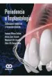 PDF Periodoncia e Implantologia. Soluciones Esteticas y Recursos Clinicos del autor Antonio Wilson Sallum