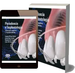 eBook libro español MEGA Periodoncia e Implantologia. Soluciones Esteticas y Recursos Clinicos