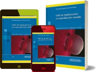 Descargar «Fallo de Implantacion en Reproduccion Asistida» PDF Español | Sef Sociedad Española de Fertilidad + ePub