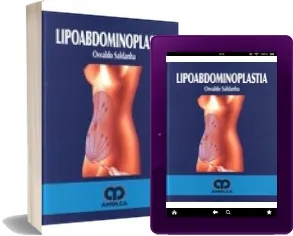 Lipoabdominoplastia descargar PDF gratis + ePub