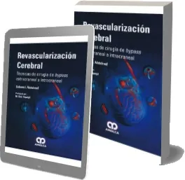eBook descargar gratis: Revascularizacion Cerebral. Tecnicas de Cirugia de Bypass Extracraneal a Intracraneal de Saleem i. Abdulrauf