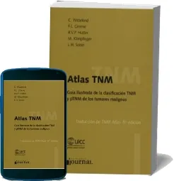 Libro Atlas Tnm. Guia Ilustrada de la Clasificacion Tnm y Ptnm de Los Tumores Malignos completo para descargar + eBook