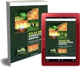 Descargar libro gratis en PDF Atlas de Operatoria Dental + eBook