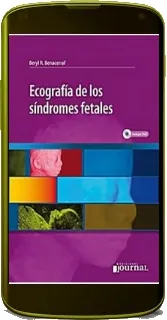 «Ecografia de Los sindromes Fetales» review + descarga directa PDF 2022 Google Drive