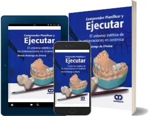 Comprender, Planificar y Ejecutar. El Universo Estetico de Las Restauraciones en Ceramica Descargar eBook de Google Drive