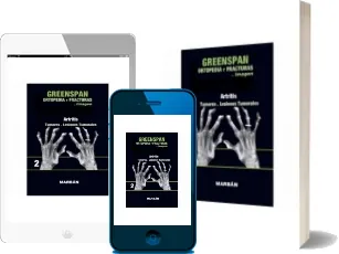 Leer Ortopedia, Fracturas y Artritis PDF + eBook