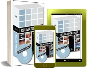 Leer PDF Reumatologia Mega #GRATIS Reumatologia PDF online + ePub