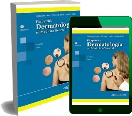 Bajar «Fitzpatrick - Dermatologia en Medicina General» de Lowell a. Goldsmith en PDF o ePub gratis para kindle 2022 Mega