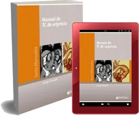 Descargar Manual de tc de Urgencias idioma Español PDF + eBook