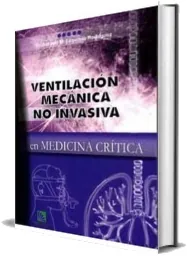 Leer y descargar Ventilacion Mecanica no Invasiva en Medicina Critica + ePub