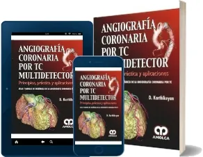 Angiografia Coronaria por tc Multidetector. Principios, Practica y Aplicaciones Descarga PDF + review y resumen 11 páginas