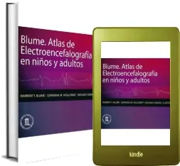 Dónde descargar Blume. Atlas de Electroencefalografia en Niños y Adultos ePub