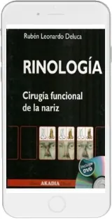 Drive Rinologia - Cirugia Funcional de la Nariz ePub de Rubén Leonardo Deluca de la editorial Akadia