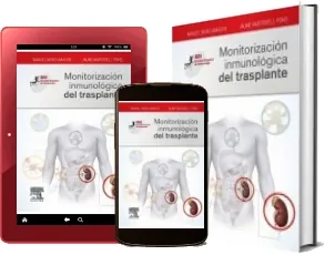 Monitorizacion Inmunologica Del trasplante eBook + ePub Descargar 2022 Google Drive