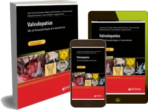 Resumen «Valvulopatias. De la Fisiopatologia al Tratamiento» PDF completo 2022 descargar