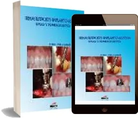Descargar Rehabilitacion Implanto Asistida editorial Ripano + eBook