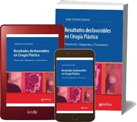 Descargar «Resultados Desfavorables en Cirugia Plastica. Prevencion- Diagnostico- Tratamiento» review + descarga directa PDF 2022 + ePub
