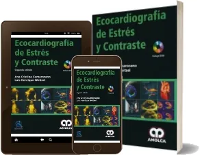 Libro Ecocardiografia de Estres y contraste PDF español Mega