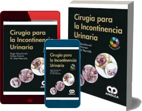 Leer Cirugia para la Incontinencia Urinaria completo PDF