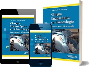 Cirugia Endoscopica en Ginecologia. Laparoscopia e Histeroscopia #GRATIS José Gerardo Garza Leal PDF online Google Drive