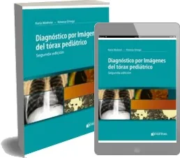 ePub descargar gratis: Diagnostico por Imagenes Del Torax Pediatrico de Karla Moenne