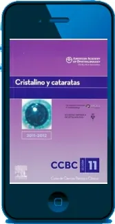 Cristalino y Cataratas, Seccion11 de James c. Bobrow completo en WORD, EPUB, TXT, PDF, DOCX, GIF, DOC - Elsevier descargar libro gratis 2022