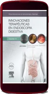 Libro Innovaciones Terapeuticas en Endoscopia Digestiva en PDF gratis + ePub