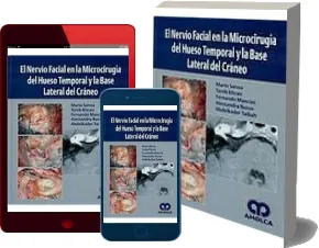 Libro completo gratis en PDF: El Nervio Facial en la Microcirugia Del Hueso Temporal y la Base Lateral Del Craneo escrito por Mario Sanna en eBook del año 2023 | Kindle - iPad