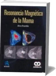 Descarga PDF Resonancia Magnetica de la Mama gratis + eBook