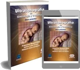Ultrasonografia en Ginecologia y Obstetricia. Guia Practica (366) páginas MEGA, FileWhopper, Microsoft OneDrive, Dropbox, WeTransfer, Apple iCloud, MailBigFile para leer en: AZW, TXT, RB, OEB, WORD, PDF, DOCX, CBR, DOC, EPUB PPMd, ACE, ZIP, ODT, DjVu, RAR Bajar sin registro