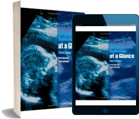 eBook 1 link Obstetrics And Gynecology at a Glance online + resumen