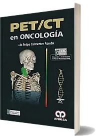 Descargar Pet ct en Oncologia PDF y eBook + resumen