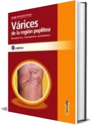 PDF Varices de la Region Poplitea online + eBook