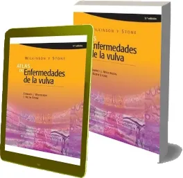 Libros completos: Wilkinson y Stone Atlas de Enfermedades de la Vulva de Edward j. Wilkinson Google Books (284) páginas Microsoft OneDrive, Dropshare, Racaty, MEGA, Apple iCloud, Dropbox, File4safe, Google Drive, MejorTorrent (Resubido)
