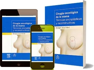 Cirugia Oncologica de la Mama. Tecnicas Oncoplasticas y Reconstructivas Descargar en español completo PDF + ePub