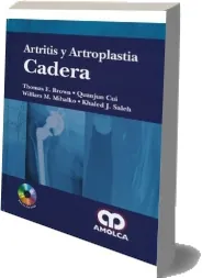 Descargar libro Artritis y Artroplastia de Rodilla completo gratis + eBook