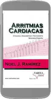«Arritmias Cardiacas» | Noel j. Ramirez - Descargar PDF o ePub 2023 Mega