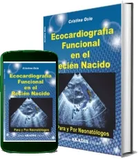 Descargar «Ecocardiografia Funcional en el Recien Nacido» eBook free Cristina Osio PDF 2023 + resumen