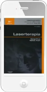 Laserterapia resumen completo gratis