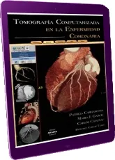 Descargar «Tomografia Computarizada en la Enfermedad Coronaria» PDF | Patricia Carrascosa | 2022 + ePub