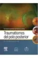 PDF Traumatismos Del Polo Posterior del autor Fernando González
