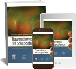 Traumatismos Del Polo Posterior Descargar gratis para iPhone/iPad/Kindle/Android Google Drive
