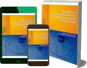 Drive Marcapasos Resincronizadores y Cardiodesfibriladores Implantables descargar