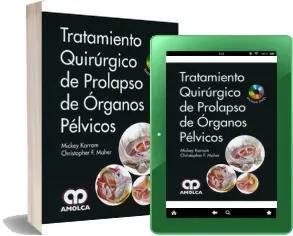 Tratamiento Quirurgico de Prolapso de Organos Pelvicos 1 Link PDF | Mickey Karram 2023
