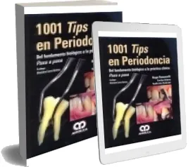 1001 Tips en Periodoncia [eBook] completo PDF + resumen